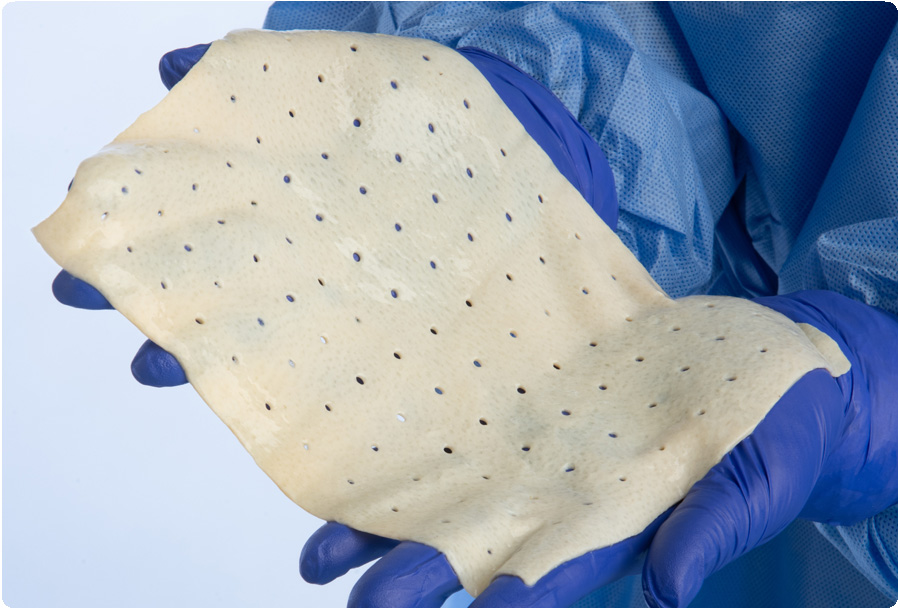 A person with white gloves holding SimpliDerm